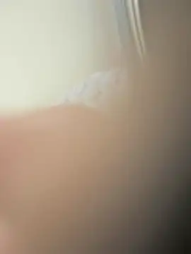 furkanktyAcalea online show from 17, 11, 2025